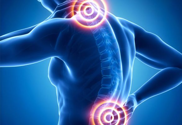 Wie entstehen Rücken- und Nackenschmerzen?