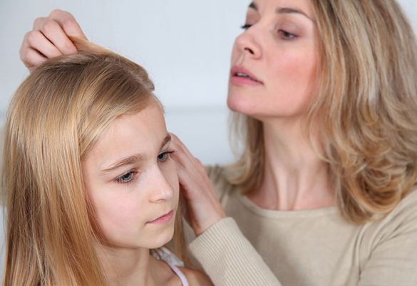 Bei einem Verdacht auf Läusebefall sollte die Kopfhaut systematisch nach bräunlichen Nissen und Läusen abgesucht werden. 